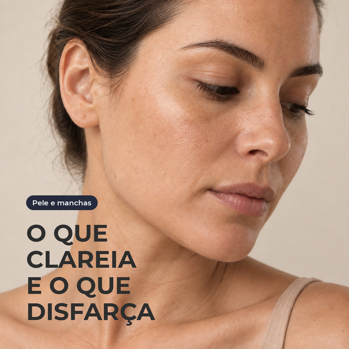 Close do rosto de uma mulher com manchas na maçã do rosto e no dorso do nariz, em luz natural