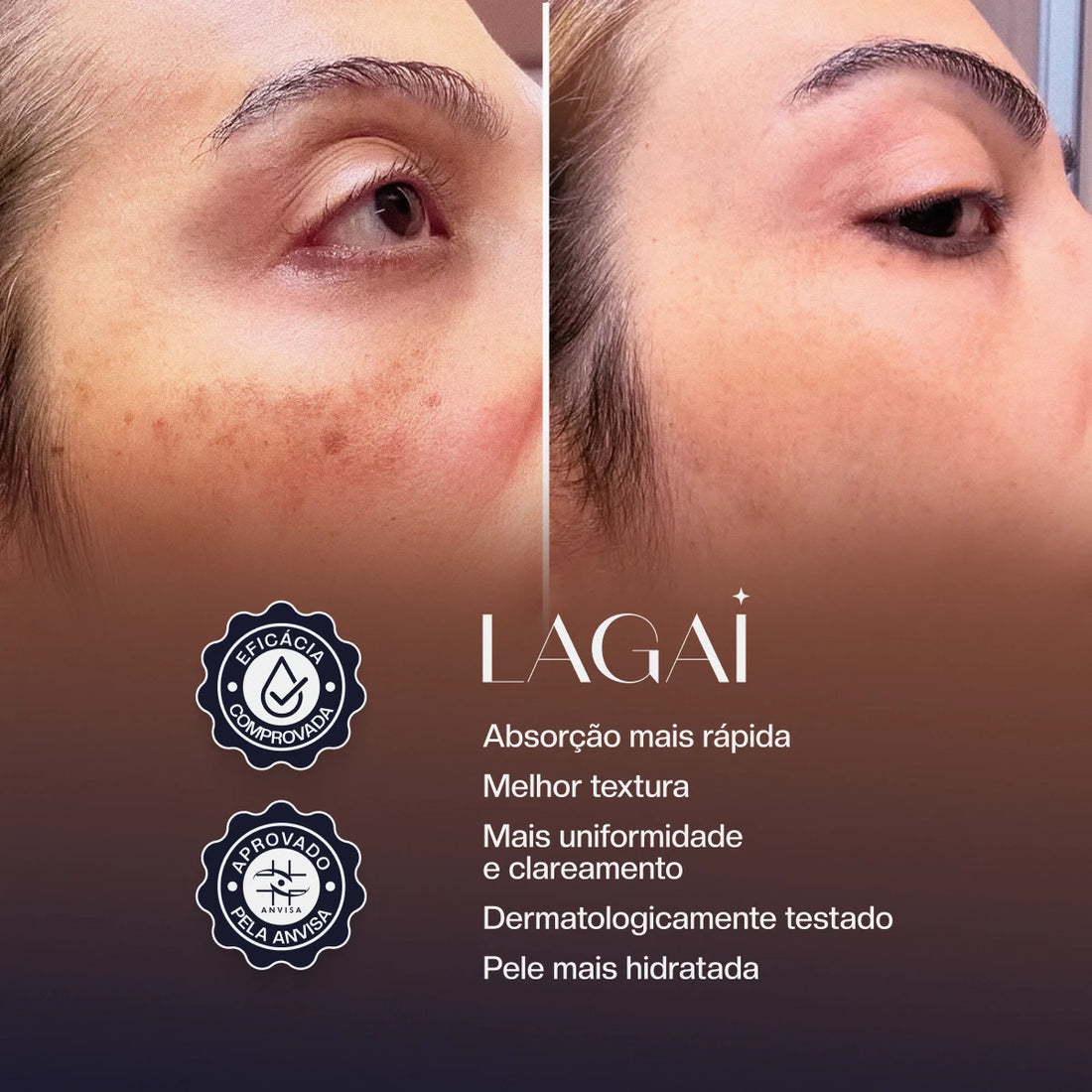 Bruma Clareadora Dermatológica MoonLit 120ml
